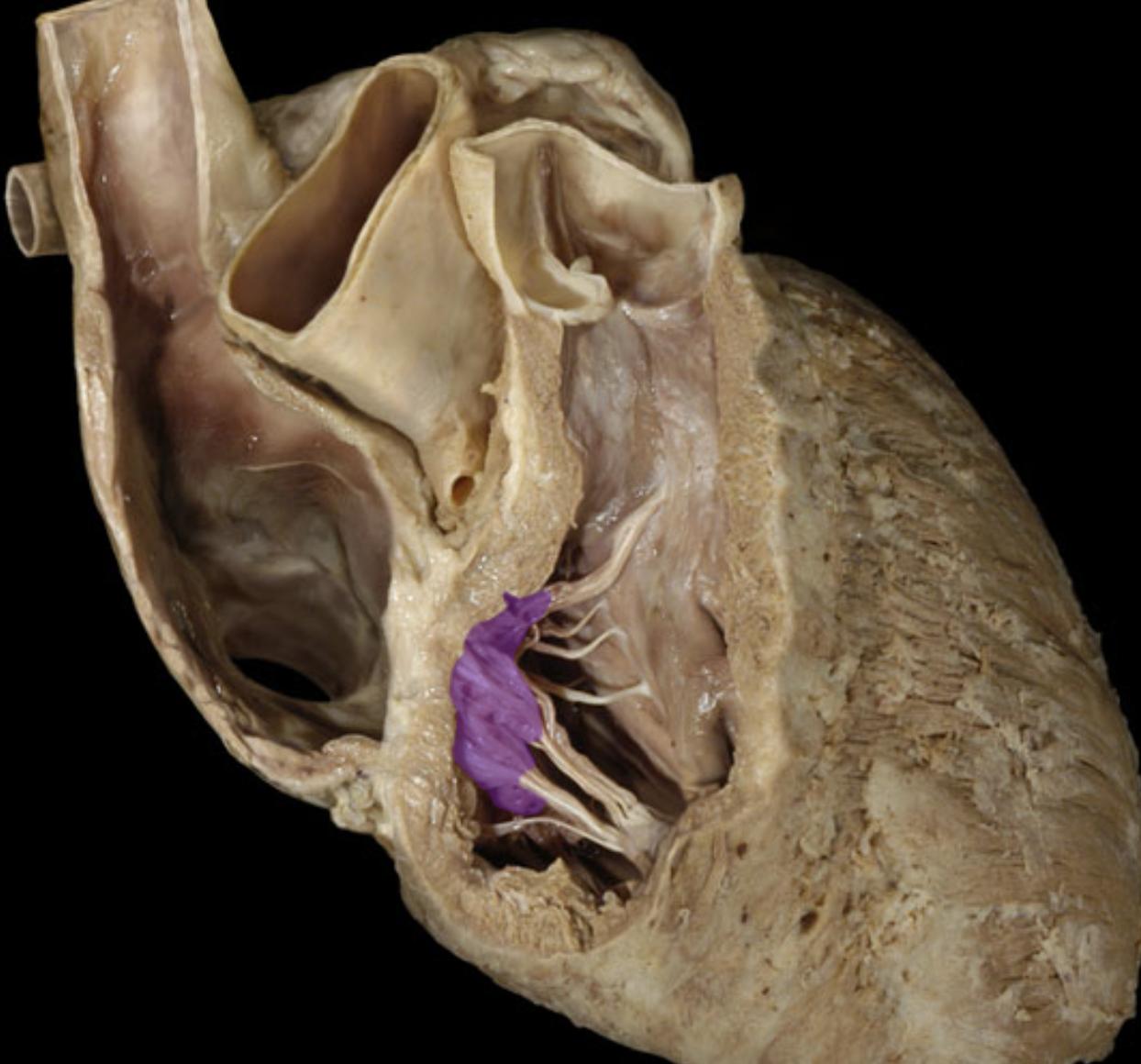 <p>Right atrioventricular valve</p>