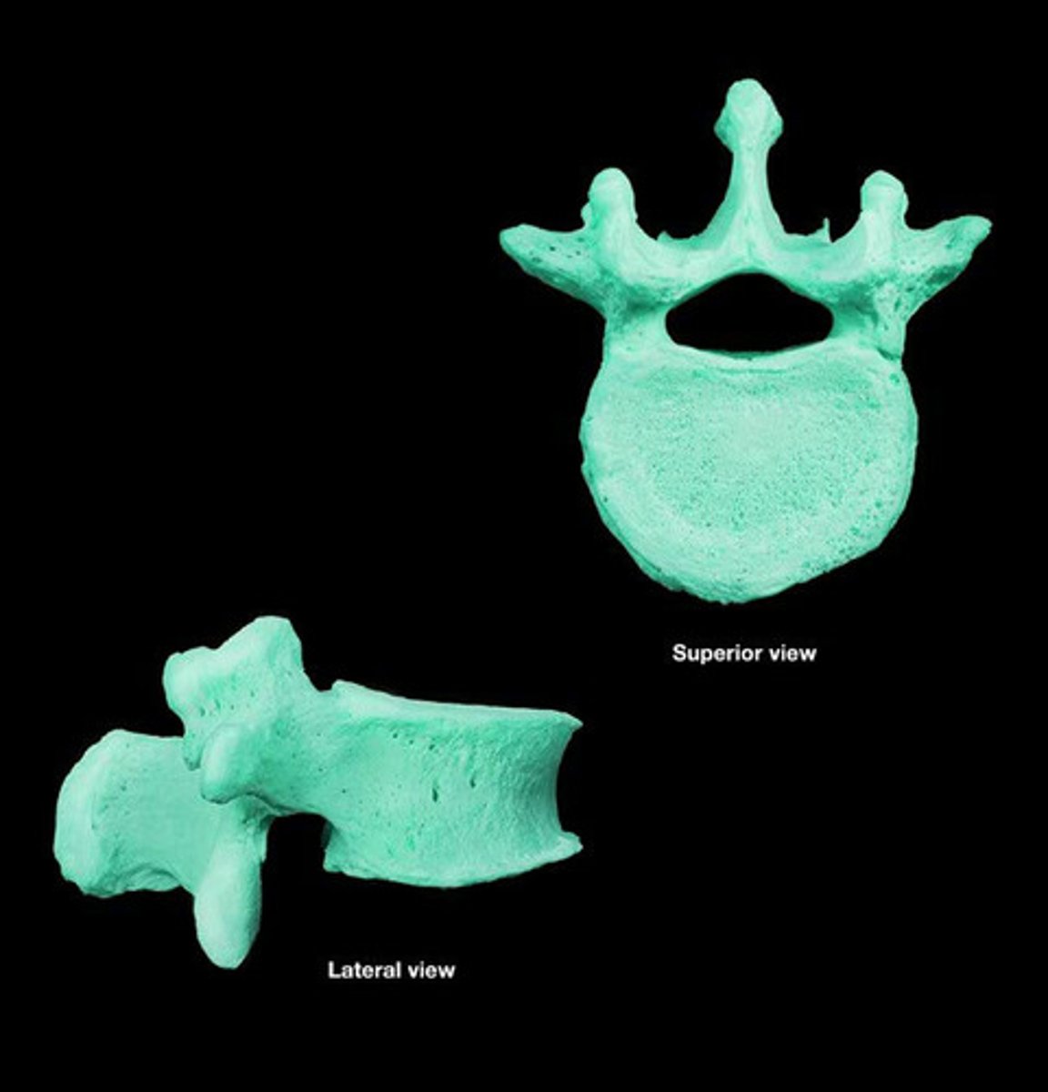 <p>Bones with complex shapes, e.g., vertebrae.</p>