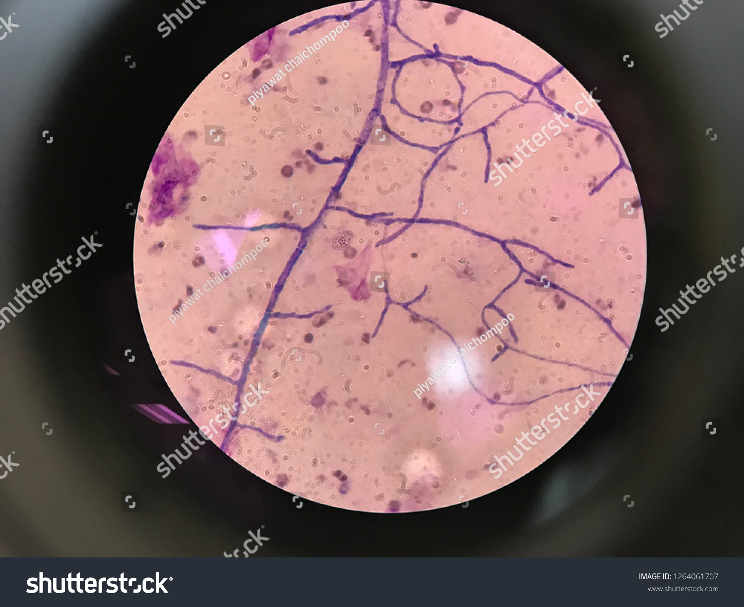 <p>How does aspergillus enter the body and what does our immune response look like?</p>