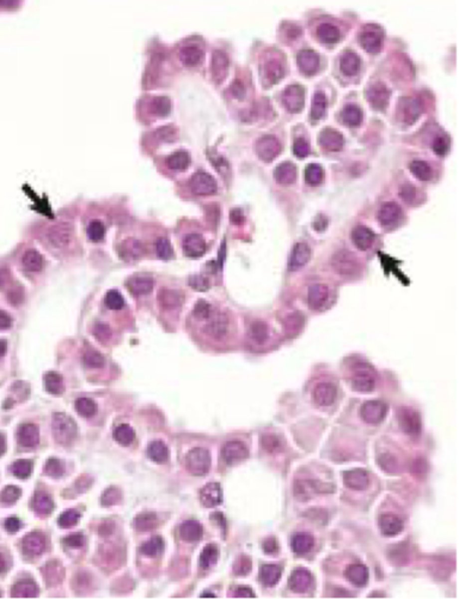 <p>ciliated (modified) cuboidal ependymal epithelium that produces CSF</p><p>- within ventricles</p><p>- supported by pia mater</p>