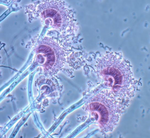 <p>Aspergillus terreus</p>