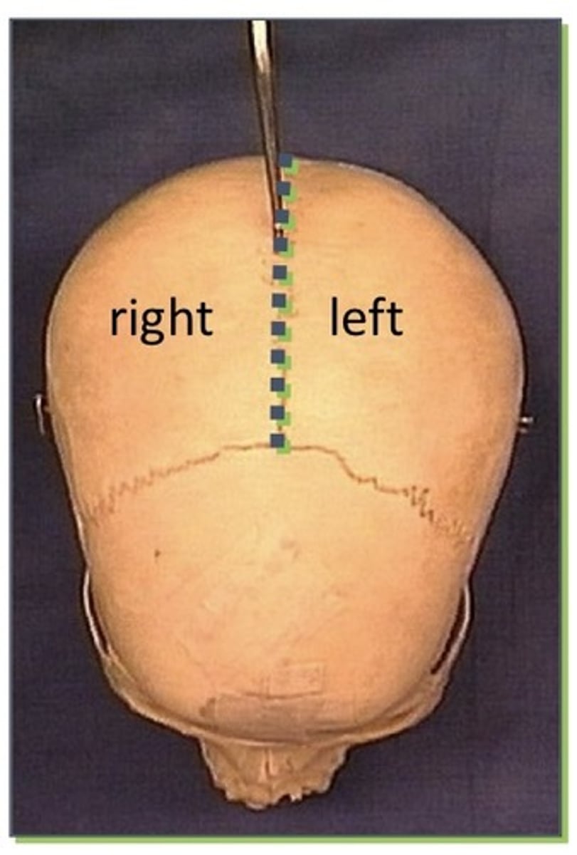 <p>1. Divides into right and left</p><p>2. An anatomic cut from the nose to the back of the head</p><p>3. An anatomic cut through only one eye</p><p>4. An anatomic cut through only one ear</p><p>5. An anatomic cut through the mouth</p>