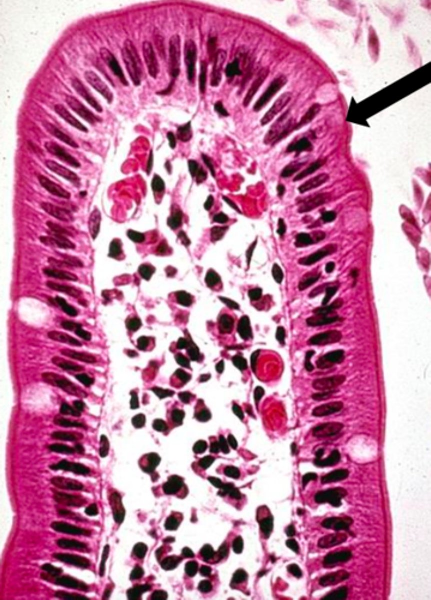 <p>classify this epithelial lining</p>