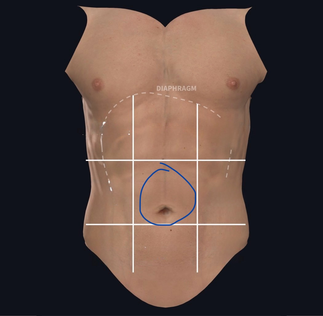 term image