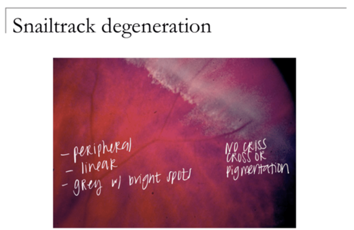 <p>Snailtrack Degeneration Pic</p>