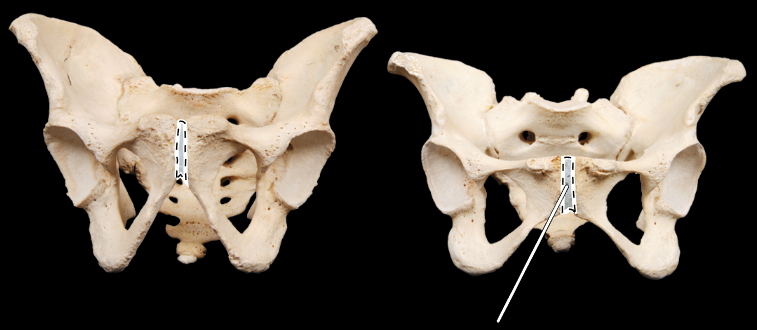 <p>Name the highlighted joint.</p><p>(Anterior view).</p>