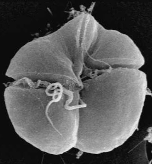 <p><span>When present in large quantities, as in harmful algal blooms [HABs], or "red tides”</span></p>