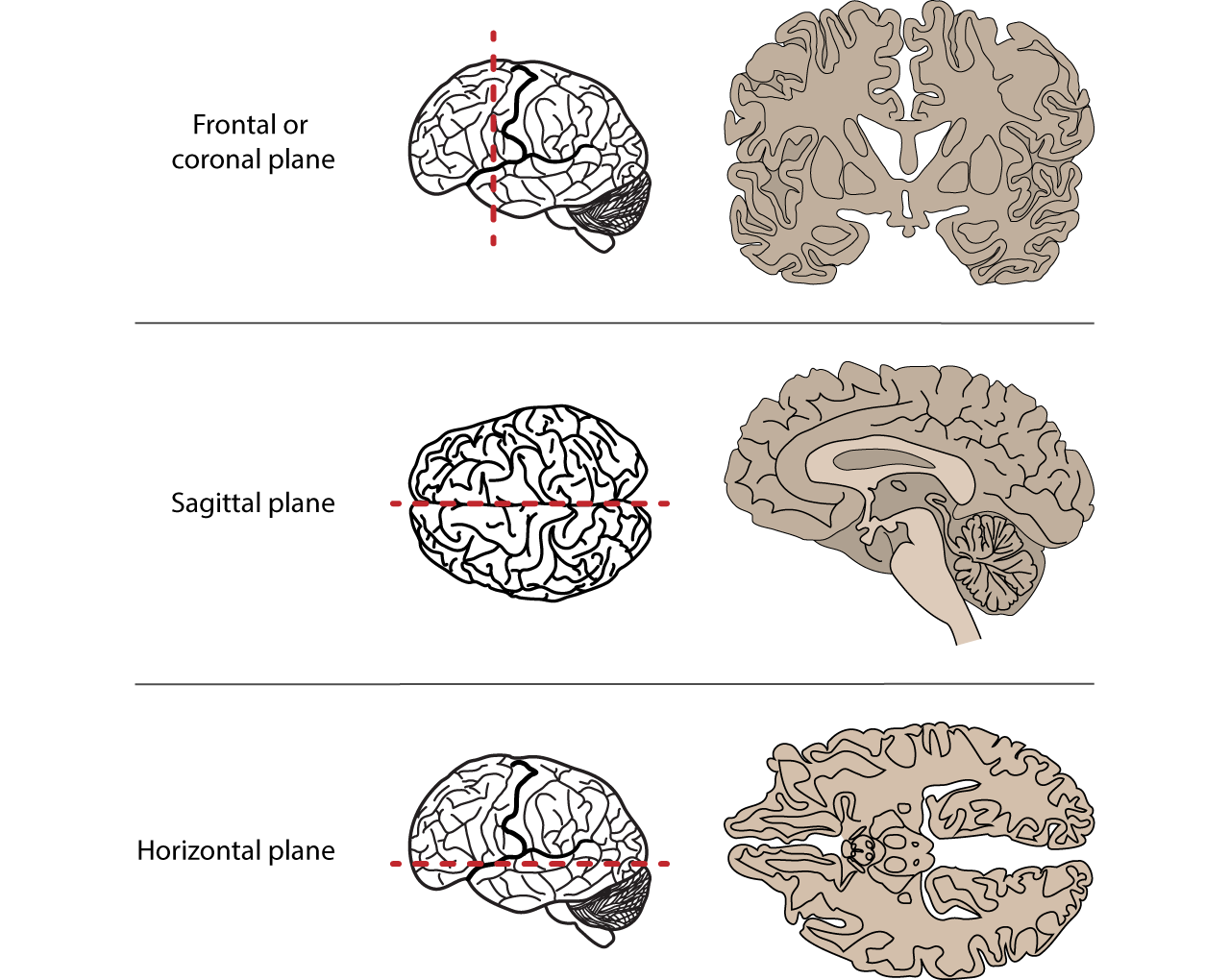 <p>Frontal plane</p>