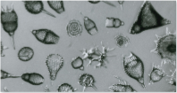 <p>among the oldest protozoa, another</p><p>group of mostly marine amoeboid protozoans. Part of “floating life” called plankton in the ocean. Silica shells. </p>