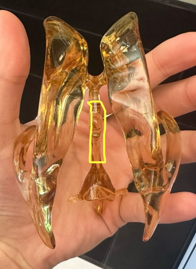 <p>What does the yellow circle indicate on the ventricle?</p>