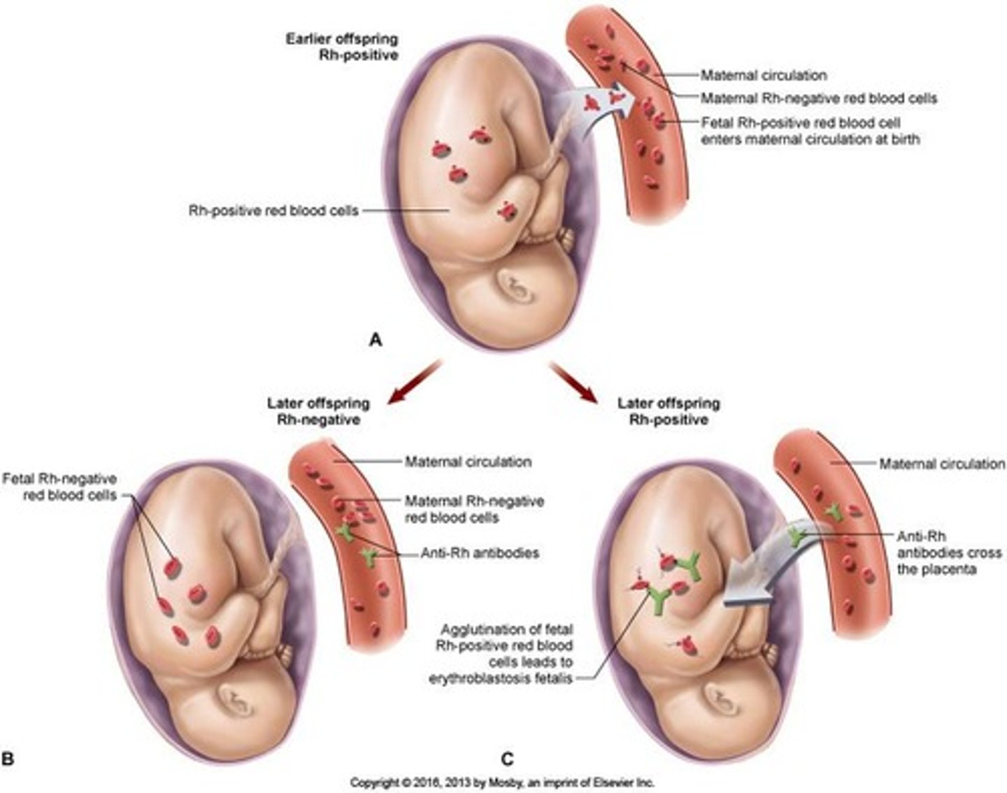 <p>It can lead to the development of anti-D antibodies and subsequent transfusion reactions.</p>