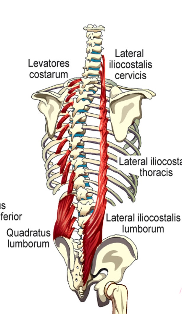 <p><span style="font-family: Century Gothic">Lateral Iliocostalis (lumborum)</span></p>
