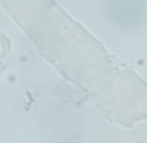 <ol start="59">
<li>Characteristics of Waxy Casts</li>
</ol>