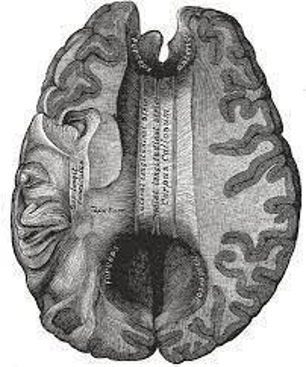 <p>Brain region involved in emotions and memory.</p>