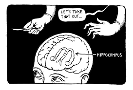 <p>H.M. suffered from <strong>epileptic seizures</strong> </p><p>The seizures increased in severity and H.M. became ultimately too disabled to work</p><p>Medicament treatments were unsuccessful </p><p> At age 27, H. M. underwent brain surgery to <strong>remove his hippocampus</strong>—the region believed to be the source of his epileptic seizures </p><p> As a result of his surgery, H.M.’s seizures decreased, but he could<strong> no longer form new memories or recall the previous 11 years of his life life.</strong> </p><p>He lost his ability to form many types of new memories (<strong>anterograde amnesia</strong>), such as new facts or faces, and the surgery also caused<strong> retrograde amnesia</strong> as he was able to recall childhood events but lost the ability to recall experiences a few years before his surgery.</p>