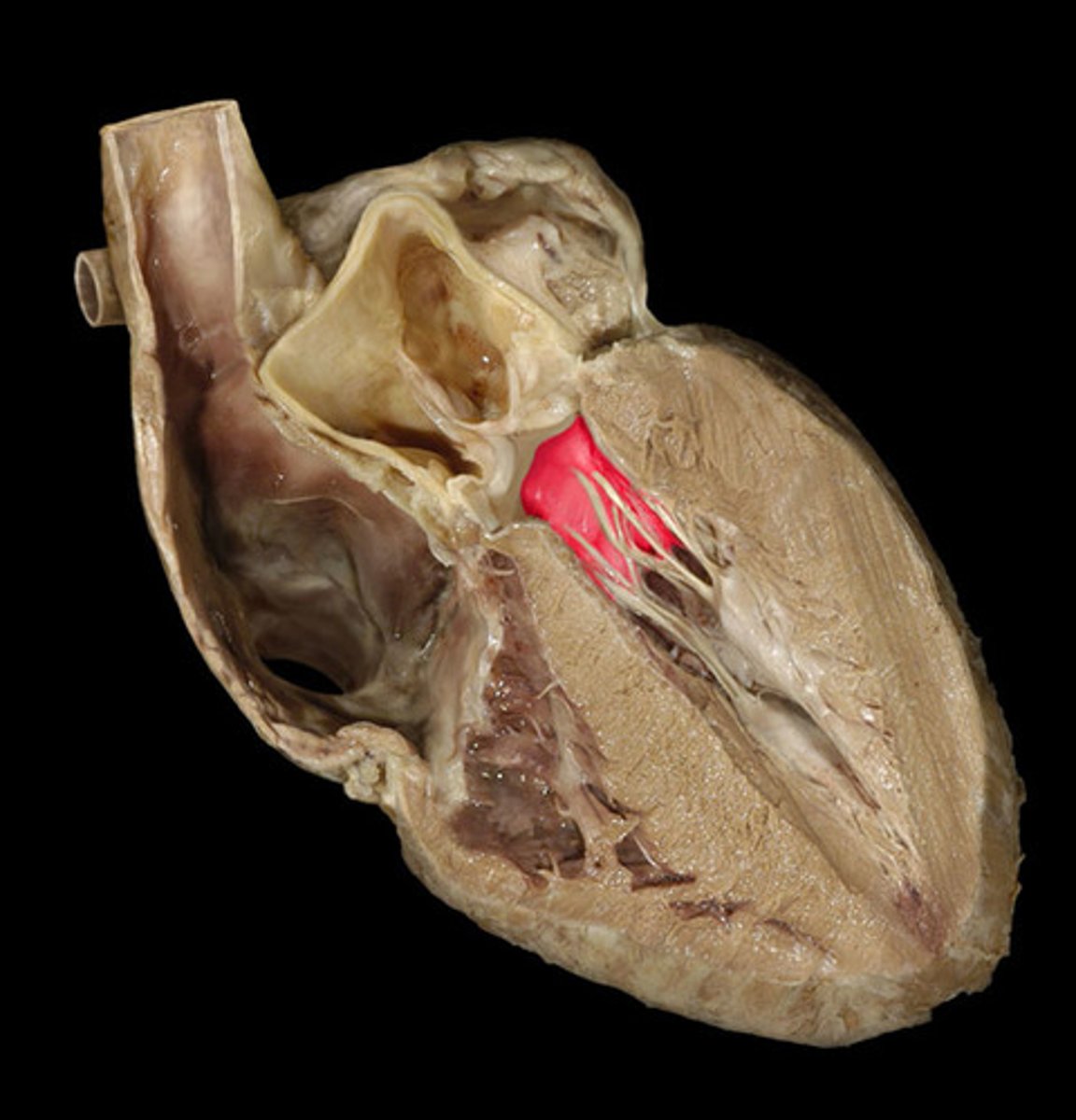 knowt flashcard image