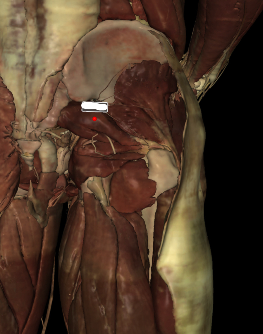 <p>Identify the Structure</p>