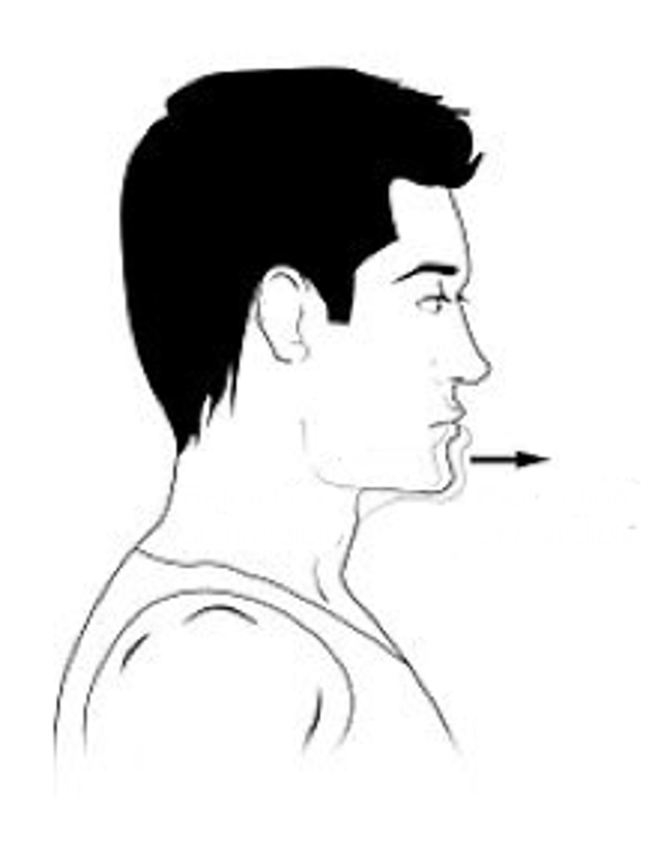 <p>Identify the action indicated by the arrow.</p>