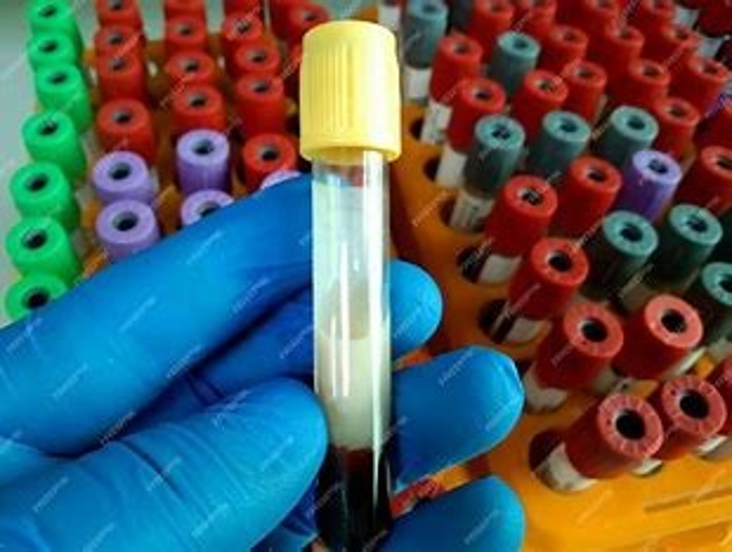 <p>Almost the entire tube will have look like butter (see slides)</p>