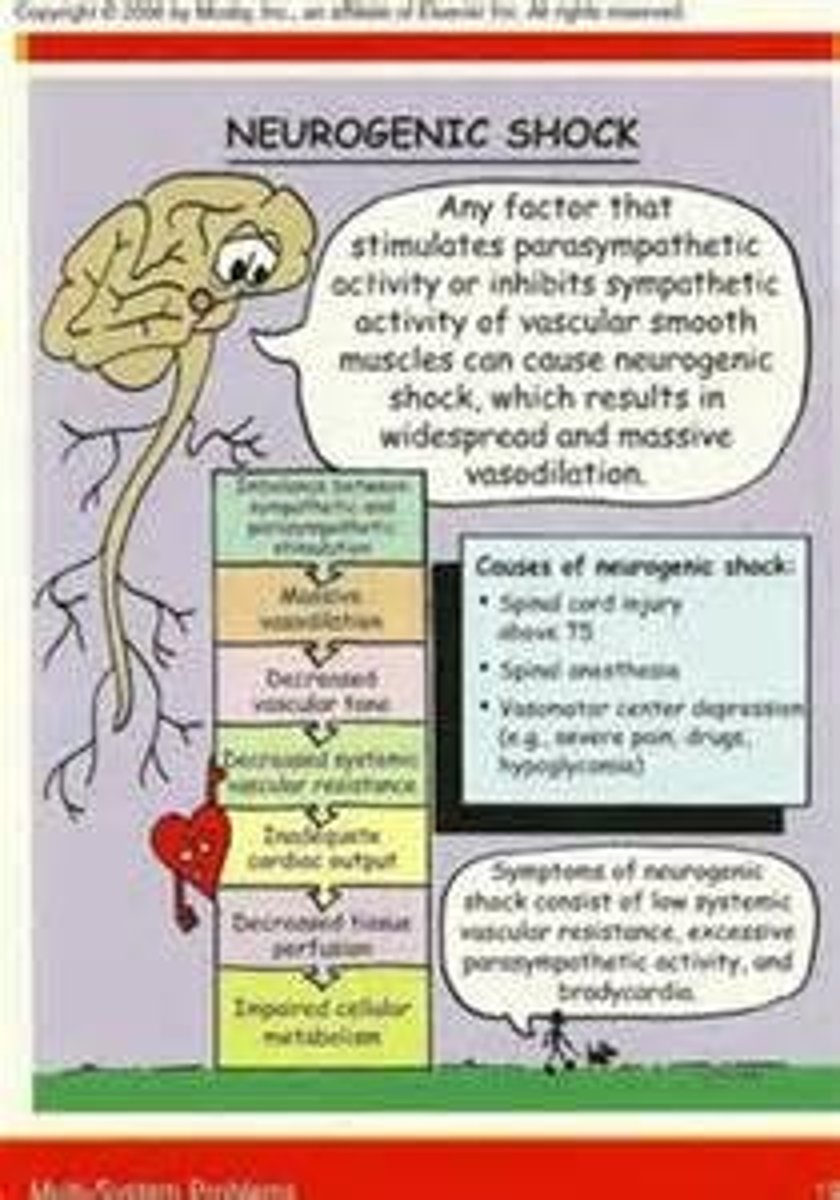 <p>Hemodynamic phenomenon that occurs within 30 minutes of spinal cord injury and can last up to 6 weeks.</p><p>What are some common assessment findings of neurogenic shock?</p><p>- severe pain, hypotension, bradycardia, not temp regulation, dry skin, initially flushed -&gt; hypothermia, vasodilation, hypotension</p><p>Causes spinal cord injury</p><p>Interventions: maintain airway (o2 intubate), cautious fluid administrations, vasopressors, atropine, stabilize spinal cord, monitor temp</p>