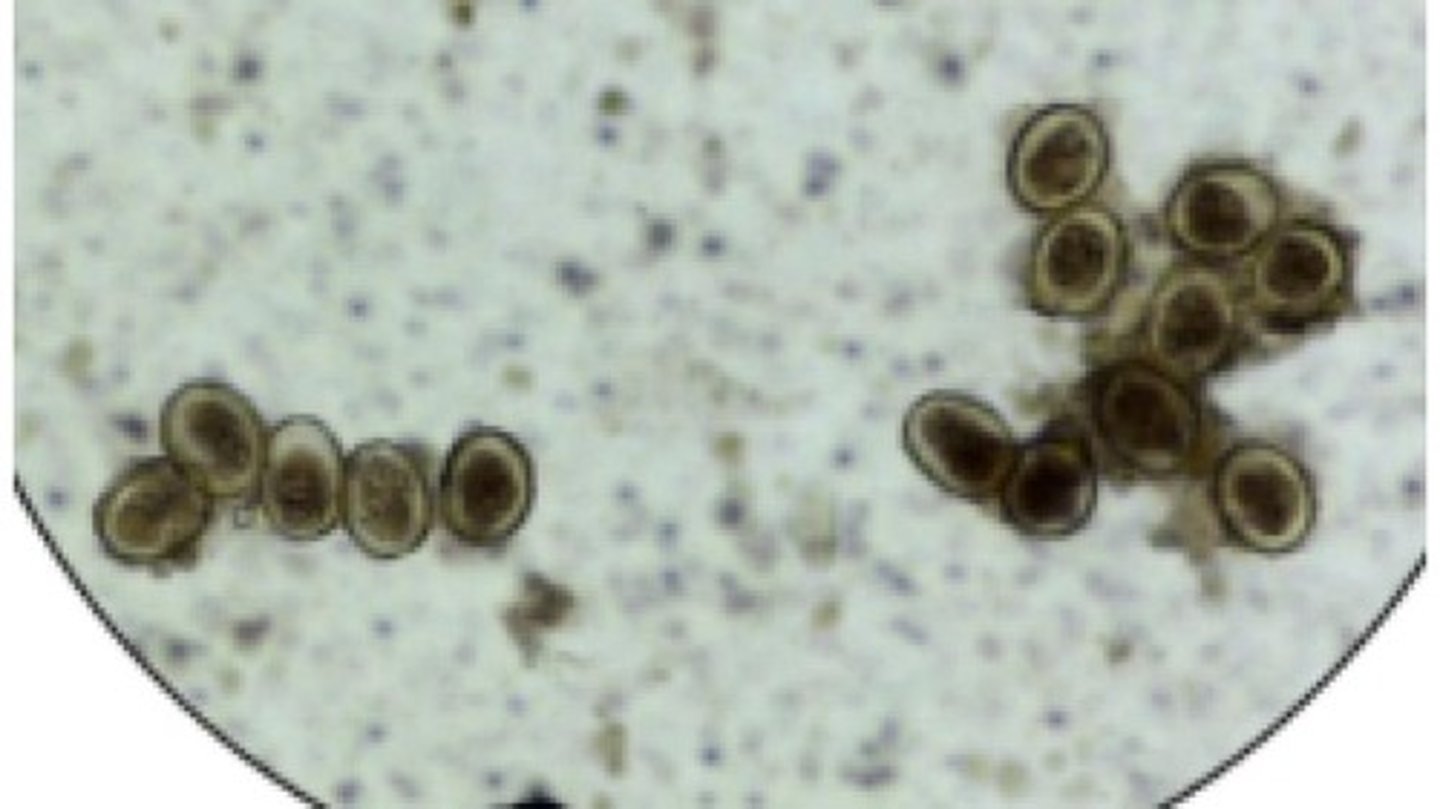 <p>Roundworm that infects the SI of swine</p><p>-Eggs are ovoid, golden brown, thick shelled with bumpy exterior</p><p>*Eggs are sticky, very resistant, & can remain infective for many years; zoonotic risk</p>
