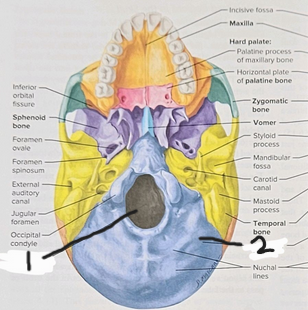 <p>What is structure #2?</p>