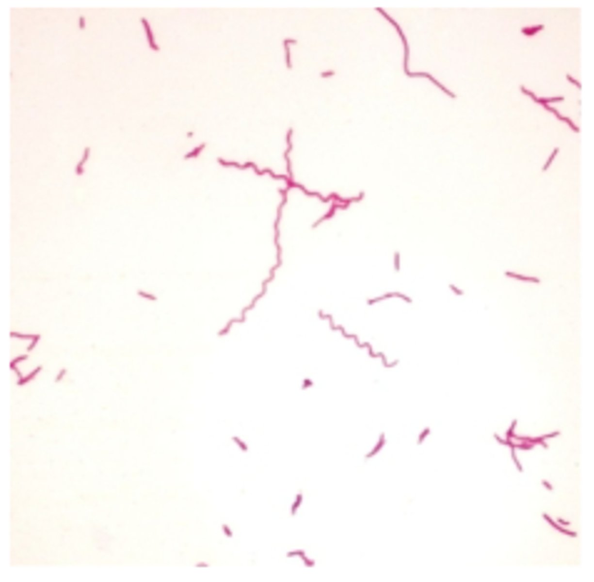 <p>Which Bacteria is this? (shape)</p>
