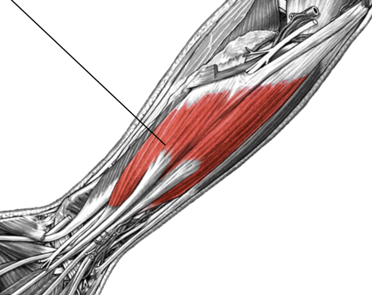 <p>Which muscle of the fingers is:</p><ul><li><p>Attached to the middle phalanx of the index, middle, ring, and pinky</p></li><li><p>Two muscles, one under the other</p></li><li><p>Action: flex fingers</p></li><li><p>Nerve: median</p></li></ul><p></p>