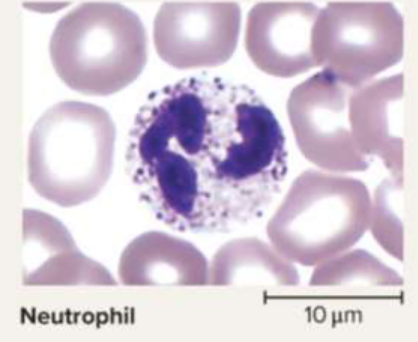<p>Neutrophils</p>
