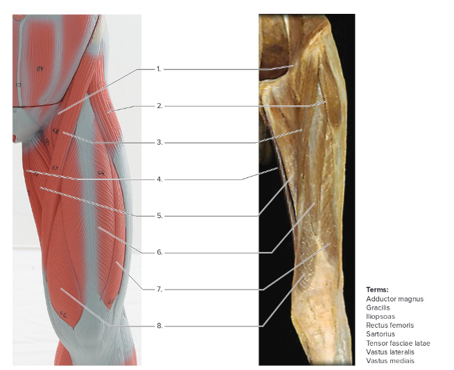 <p>Label the following: Muscle model </p>