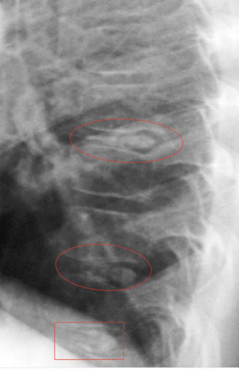 <p>What is the red</p>