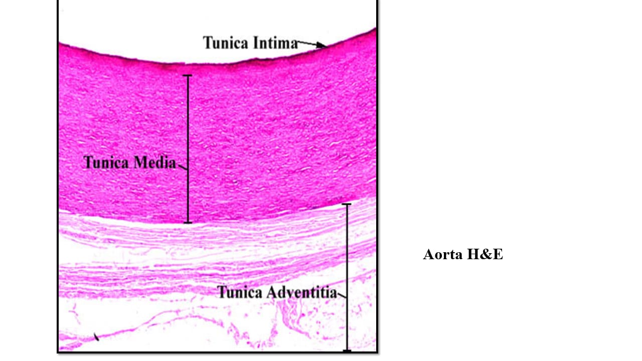 <p>Aorta – LM – H&E</p>