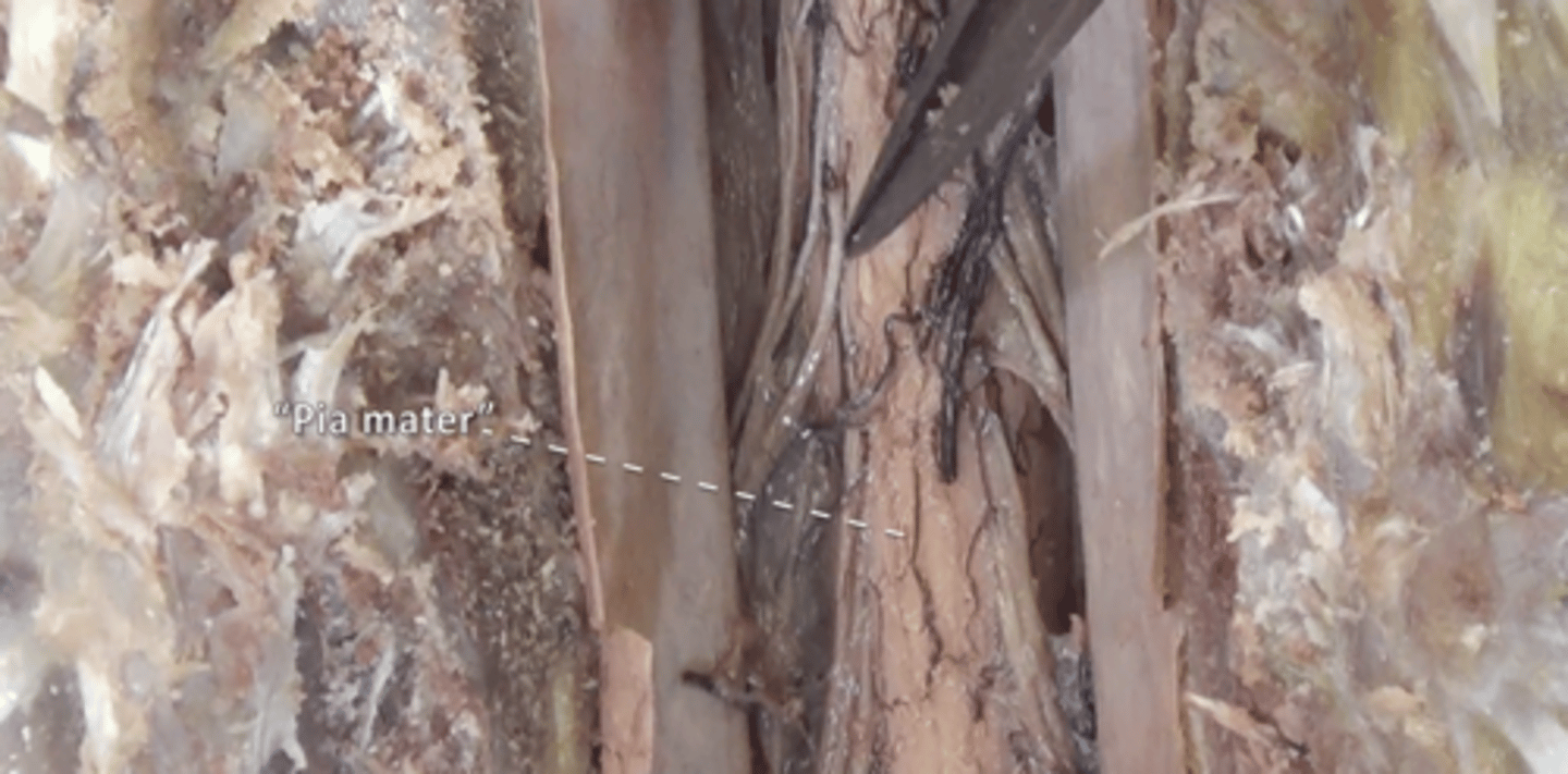 <p>thin, delicate inner membrane surrounding the spinal cord</p>