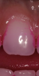 <p>what is the score for 8 F</p>