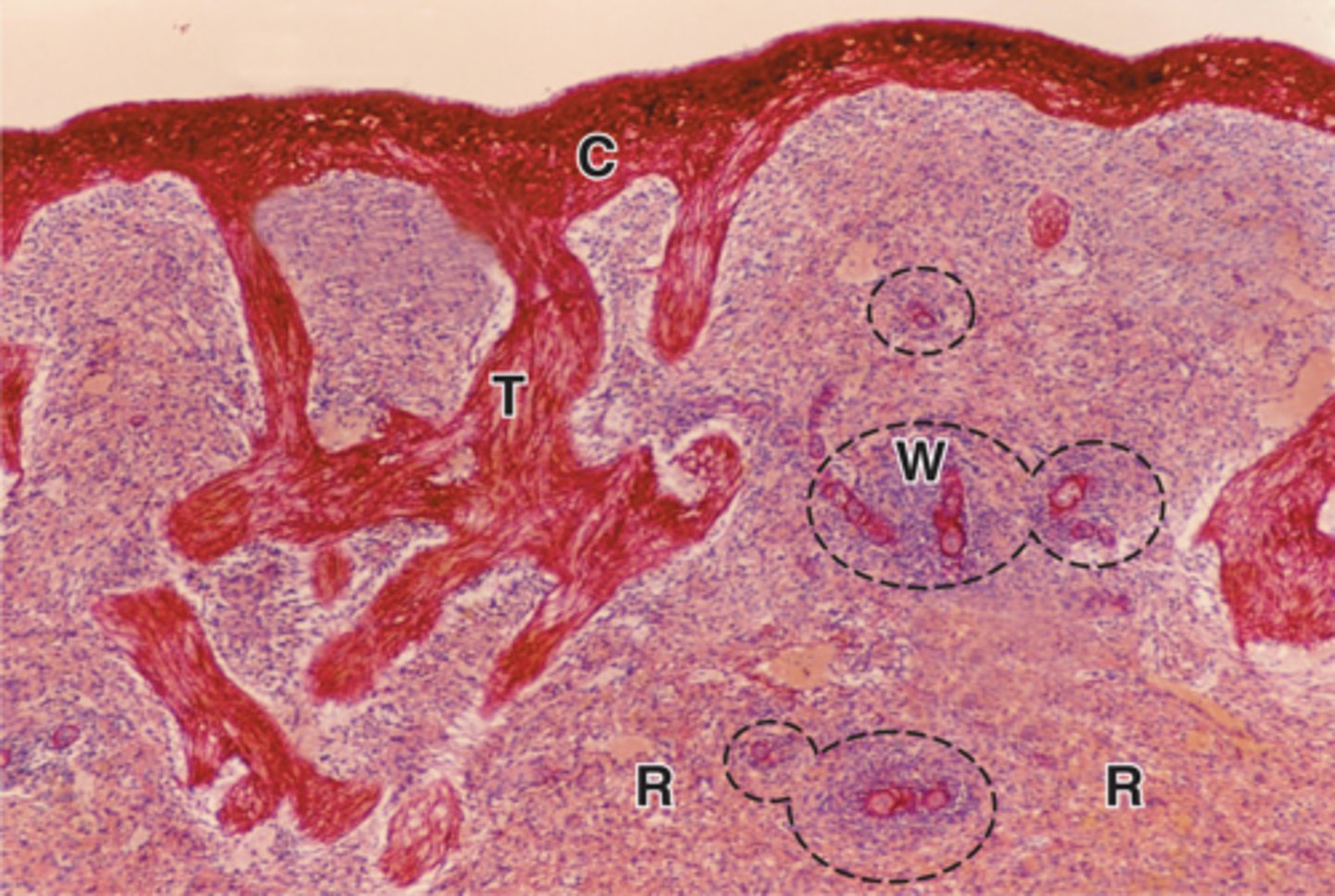 <p>where is this tissue located?</p><p>spleen</p>