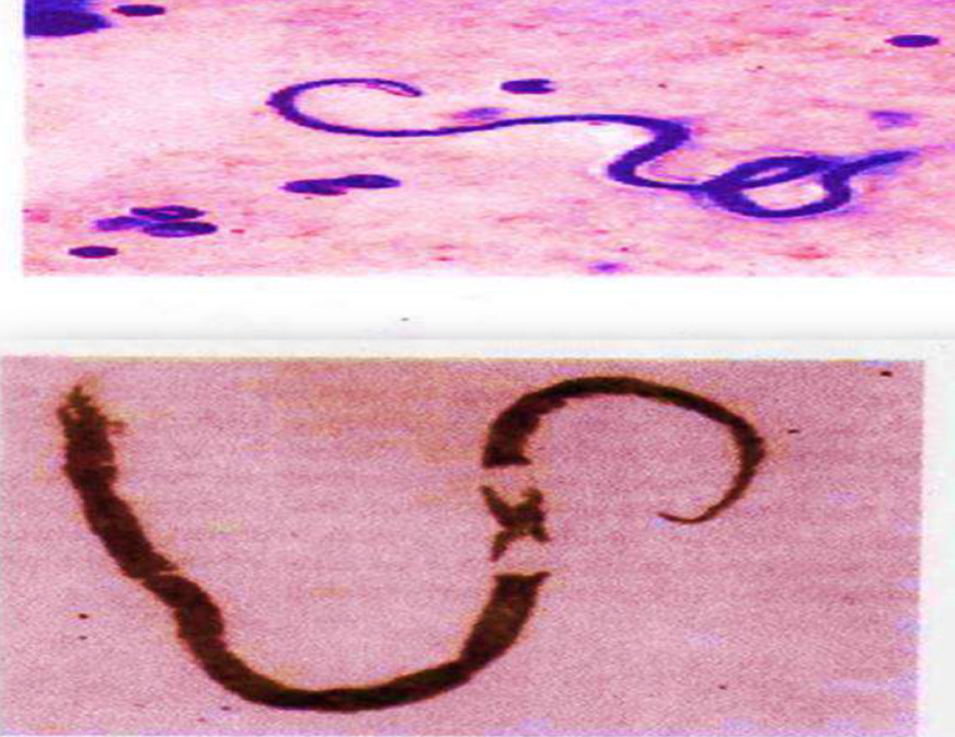 <p>parasite under microscope </p>
