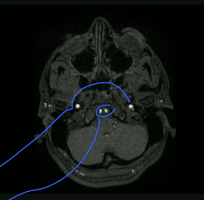 <p>What vessels are Lateral and Medial</p>