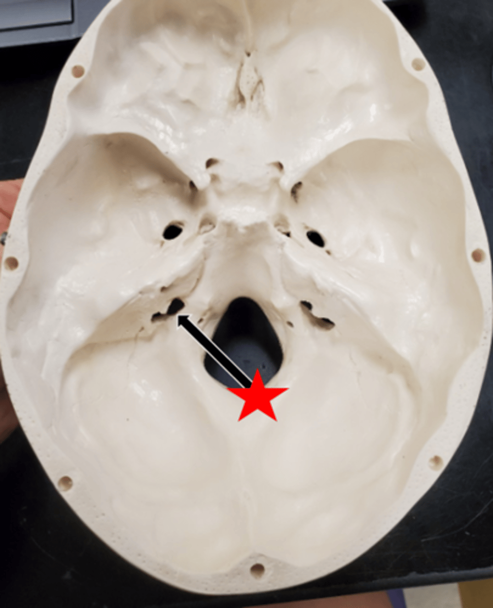 <p>Name the starred region in the image.</p>