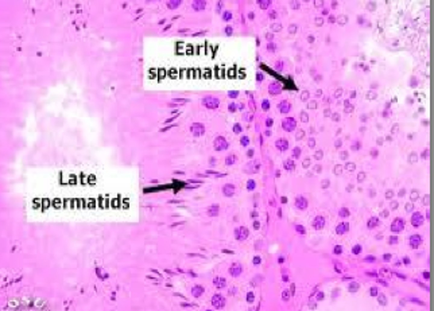 <p>formed from two secondary spermatocytes that undergo another round of cell division to make two haploids.</p>