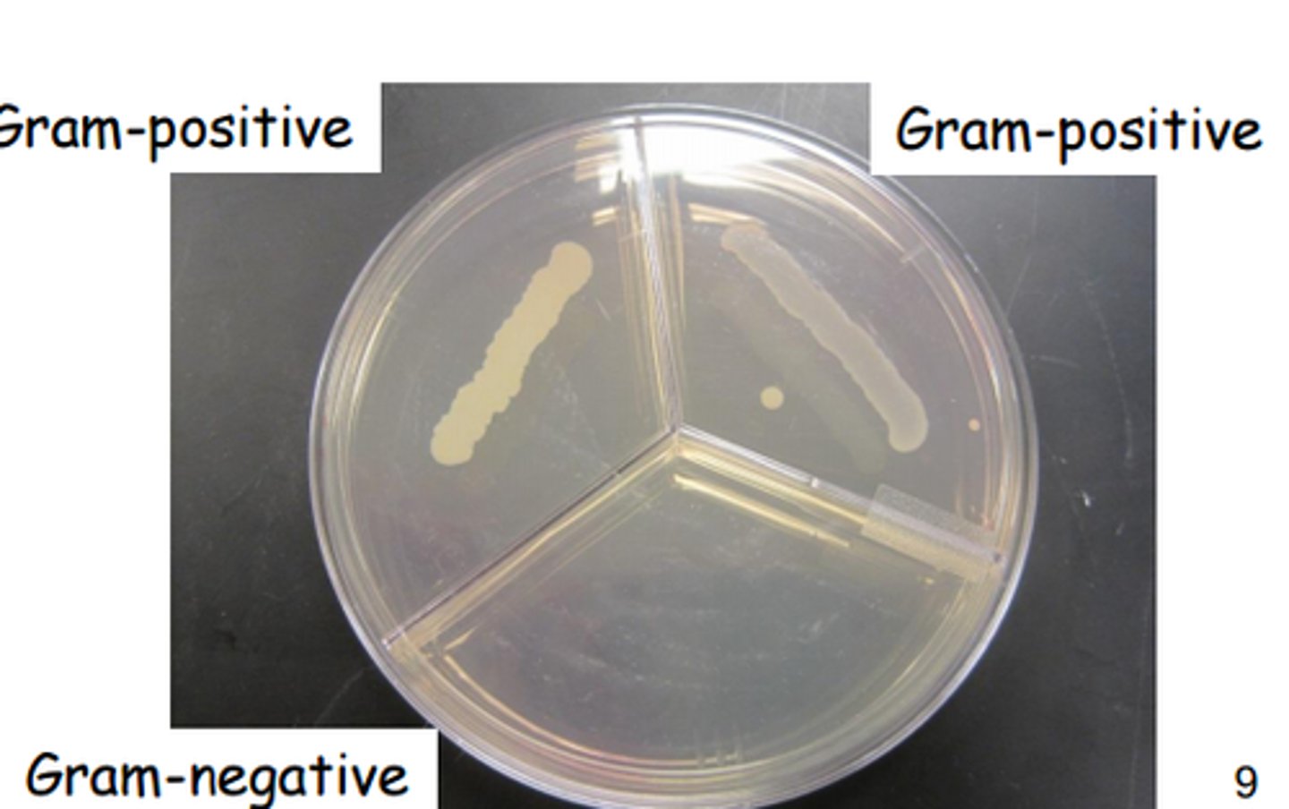 <p>PEA - Phenyl Ethanol Agar</p><p>1. phenyl ethanol (alcohol)</p><p>2. phenyl ethanol (alcohol)</p><p>4. growth</p><p>5. no growth</p><p>6. selective media</p>