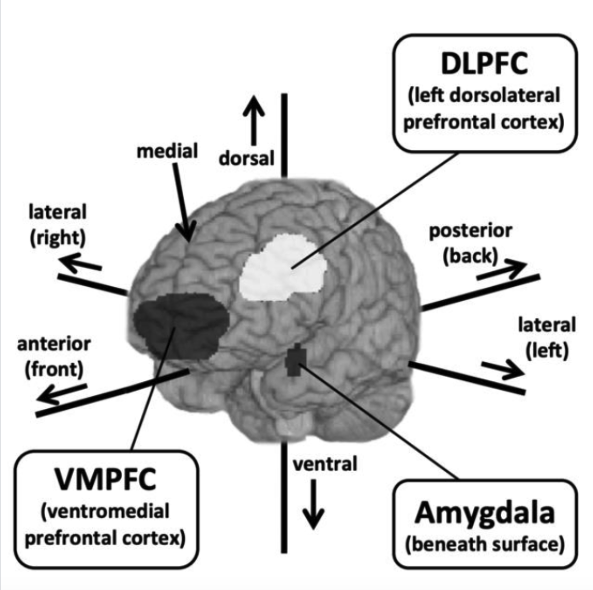 <p>One of the functional parts of the prefrontal cortex (white part)</p>