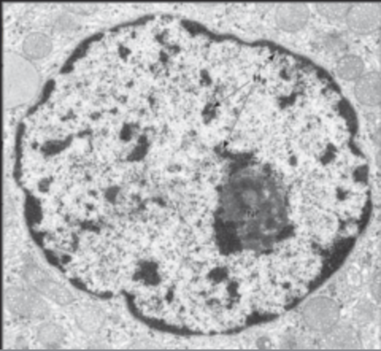 <p>Identify the following structures in electron micrograph (the whole structure)</p>