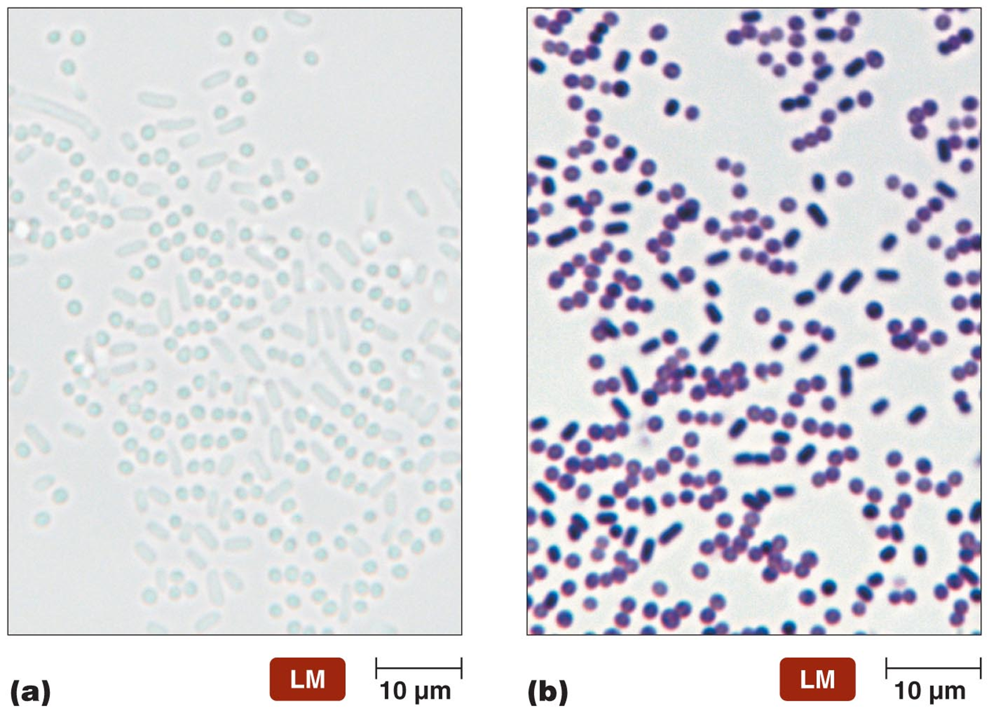 left: no stain
right: CV