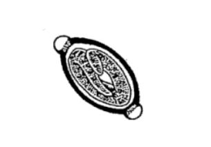 <p><em>Trichuris trichiura</em></p>