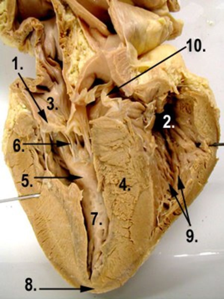 <p>Identify the chamber labeled 2</p>