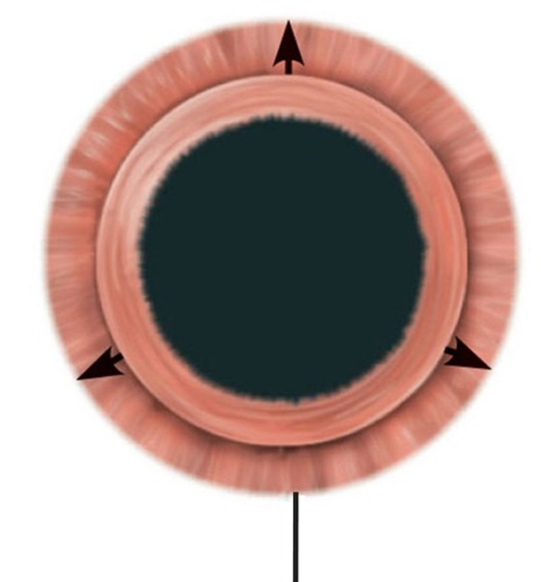 <p>-Spoke-like myoepithelial cells</p><p>-Sympathetic stimulation widens pupil</p><p>-Occurs in dark light conditions/ when shifts between distant and nearby objects</p>