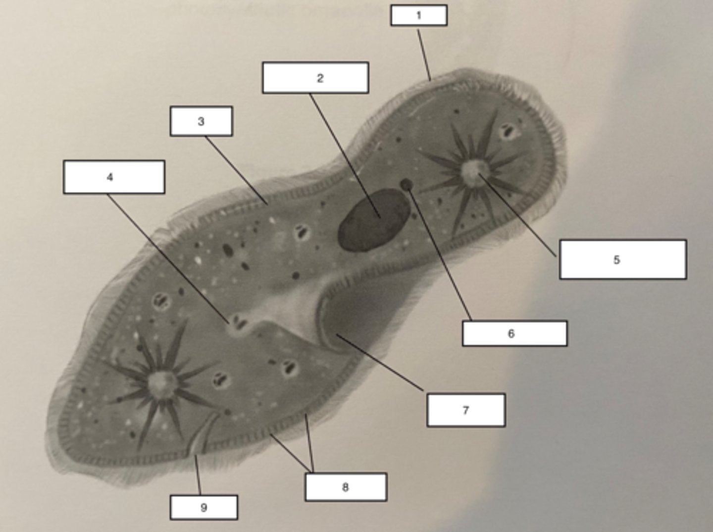 <p>The cell structure that collects extra water from the cytoplasm and then expels it from the cell</p>