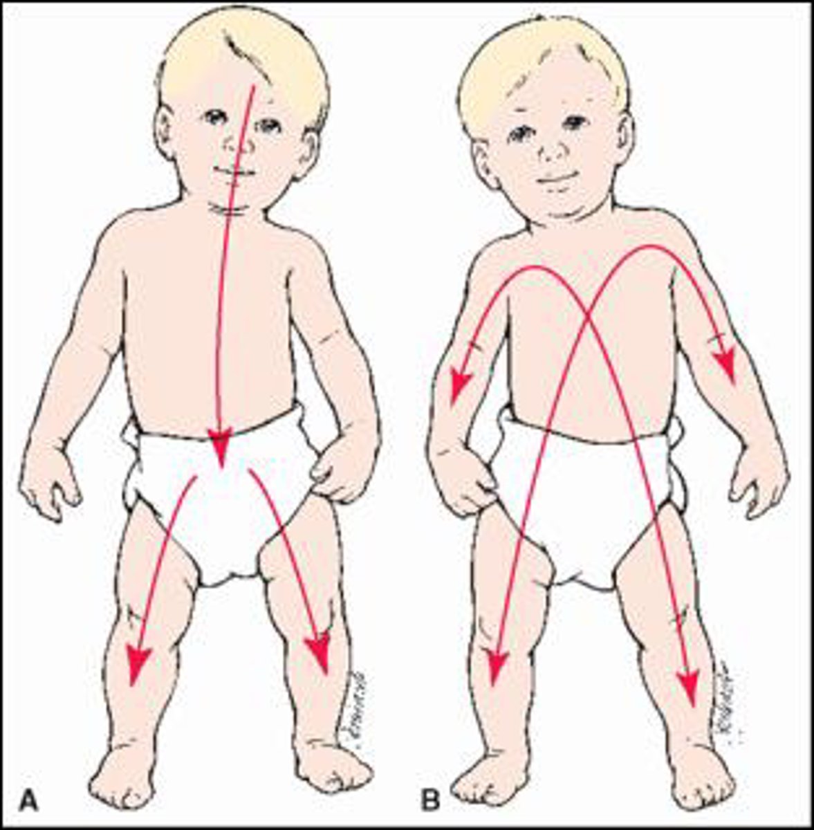 <p>Proximal to distal (shoulder --&gt; finger)</p><p>In the picture...</p><p>A = cephalocaudal (Gross motor)</p><p>B = proximal to distal (Fine motor)</p>