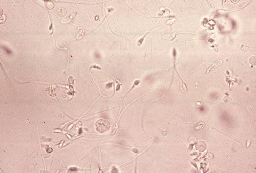 <p>These cells&apos; purpose is to fertilize ova (sing. ovum) and thus determine the sex of the ova after being fertilized. They contain half of the normal human genetic material, being considered haploid.</p>