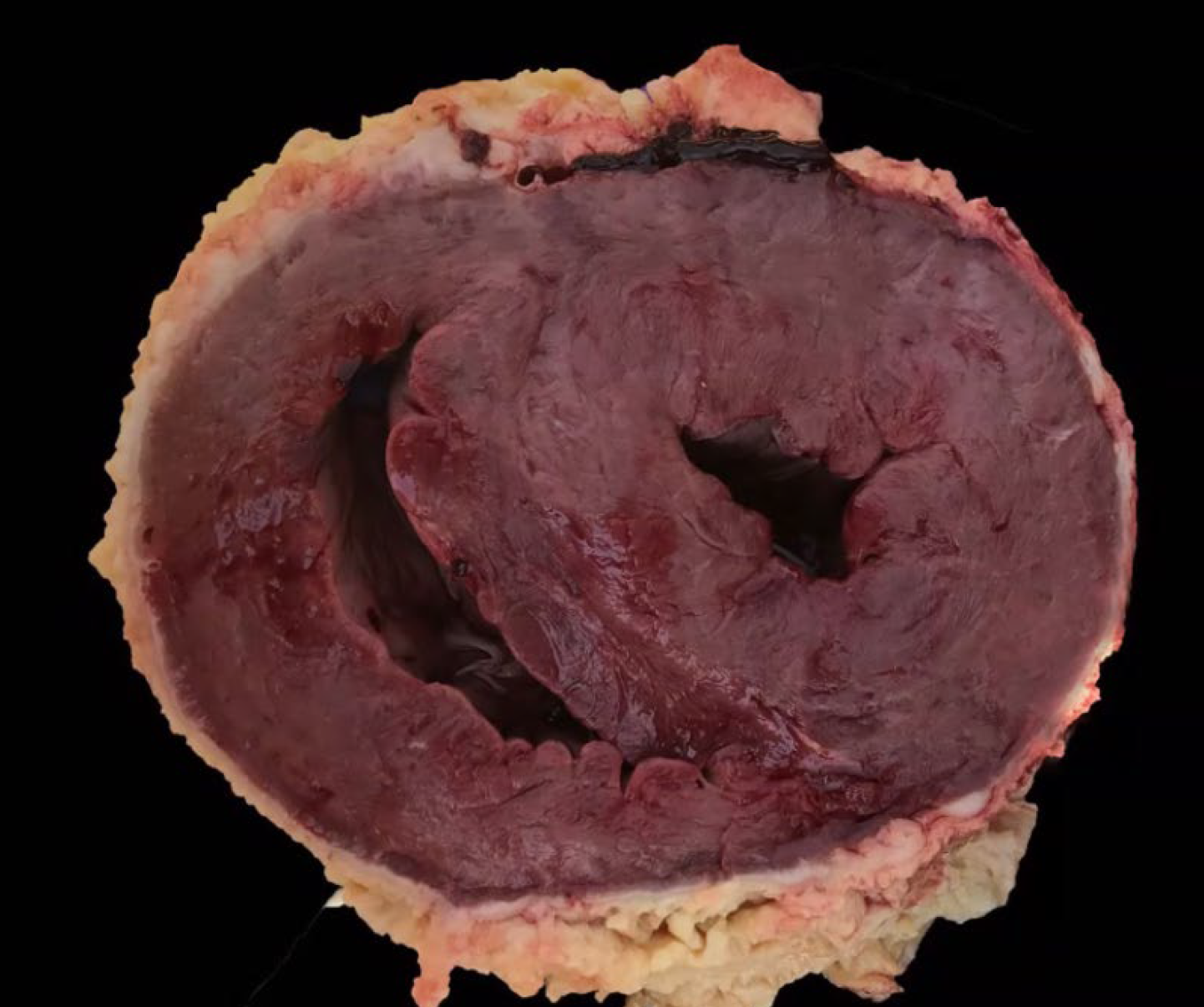 <p>What other organ you should examine?</p><p>A-Abomasum</p><p>B-Reticulum</p><p>C-Duodenum</p><p>D-Trachea</p>